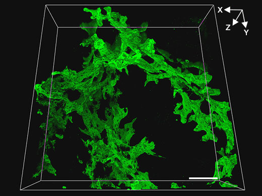 Observation tridimensionnelle des structures de l’arbre biliaire d’un foie de souris présentant des lésions avec un objectif x20 (UPLSAPO20X [ON : 0,75, DT : 0,6 mm])