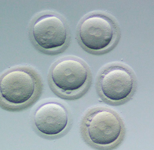Fertilized Embryo