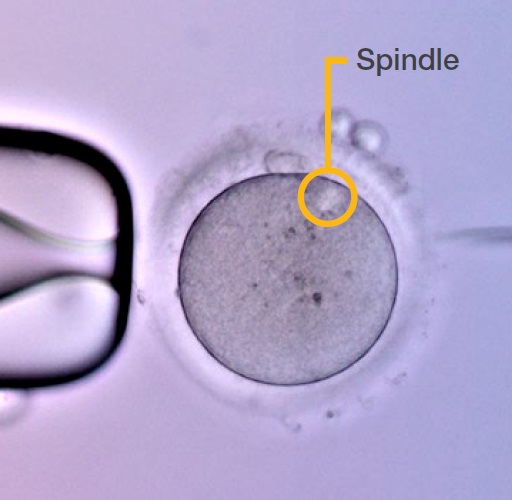 Spindle (observação de polarização)