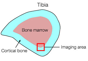 Figure 1: Tibial cross-section