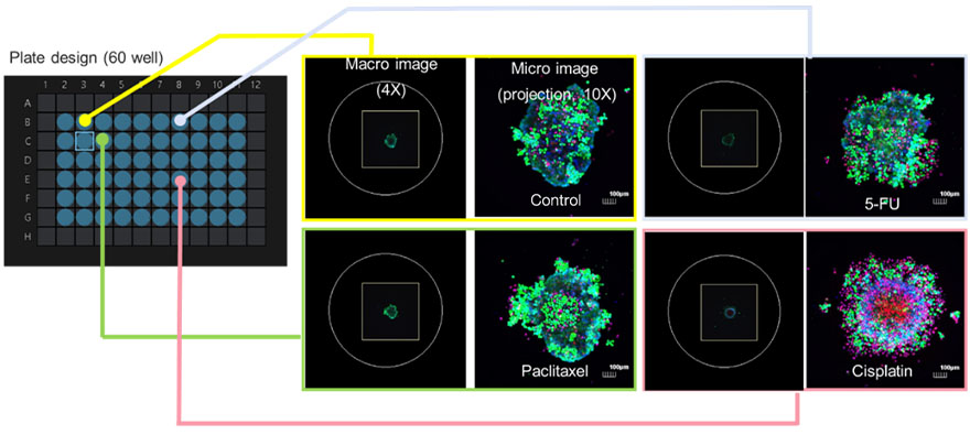 Figura 6. Las imágenes para determinar la vida y la muerte celular son capturadas automáticamente por el módulo de procesamiento de imágenes de macro a micro.