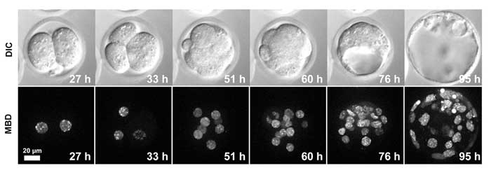 Fig2. メチローマウスを用いた着床前初期胚発生過程のライブセルイメージング画像 核内のメチルDNA（mCherry-MBD-NLS）の変化を約4日間観察