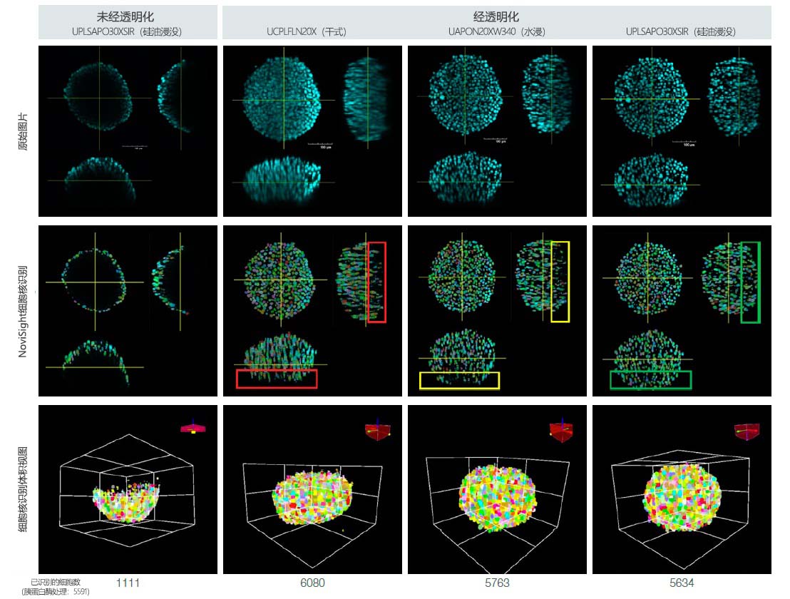 图3.微球透明化和物镜选择对3D细胞计数的影响。