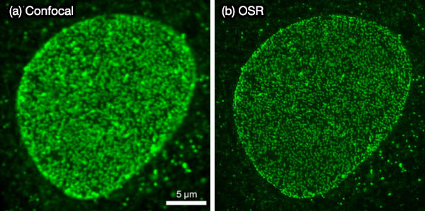그림 7. 고정된 세포의 착색 핵공을 보여주는 형광 이미지: (a) OSR을 적용하여 IXplore SpinSR 시스템으로 획득한 이미지와 (b) 컨포칼 현미경으로 획득한 이미지.
