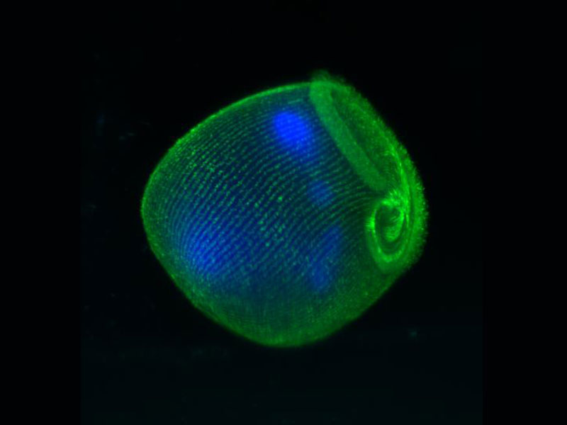 Fixed Stentor, GFP cilia and DAPI poly-nuclei at 10x magnification