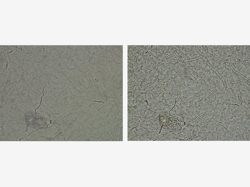 左图：孔径光阑闭合且聚光镜朝下的CX41/右图：孔径光阑闭合的CX43 /样品：毛癣菌