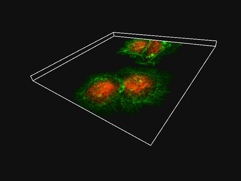 画像：HeLa細胞（緑: アクチン, 赤: チューブリン）