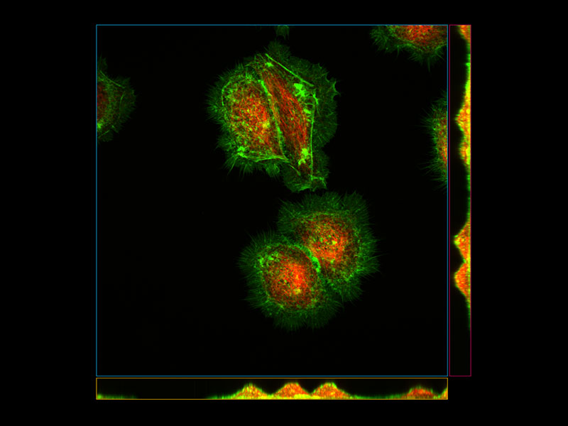 画像：HeLa細胞（緑: アクチン, 赤: チューブリン）