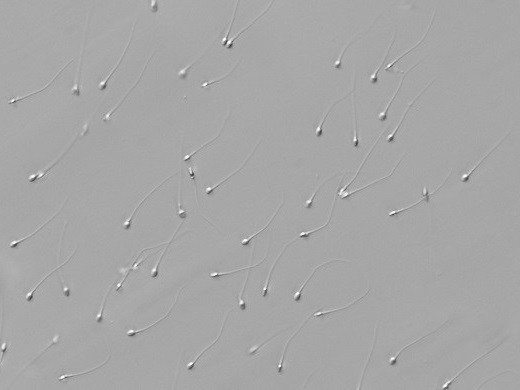 Morphological evaluation of sperm in high magnification 1x