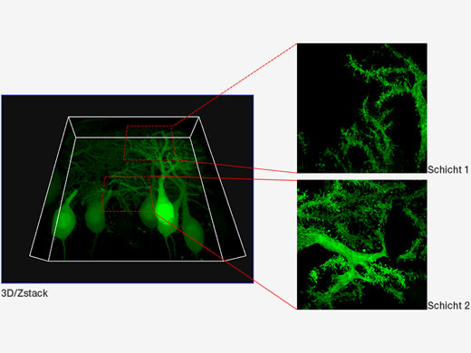Mit GFP markierte Purkinje-Zellen XYZ-Bild mit konfokaler und superauflösender Darstellung in verschiedenen Z-Positionen. Superauflösende Bilder werden mit Z projiziert (10 Schnitte). 3D-Darstellung mit FV31S-DT.