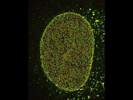 Complexo de poros nucleares de células HeLa 