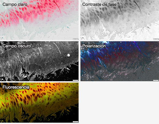 Varios métodos de observación y una imagen superpuesta con campo oscuro y fluorescencia