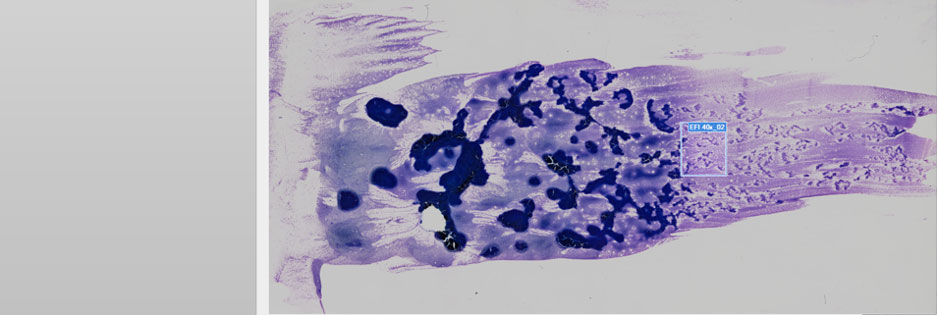 Imagerie sur lame entière d’un échantillon de sang périphérique