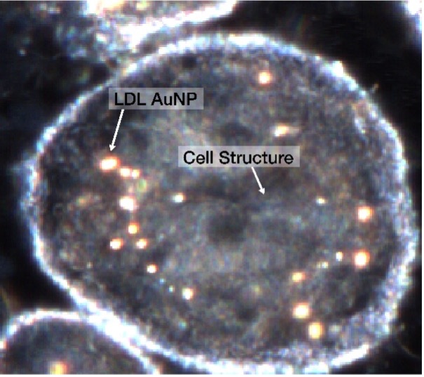 マクロファージ細胞の強化暗視野観察画像