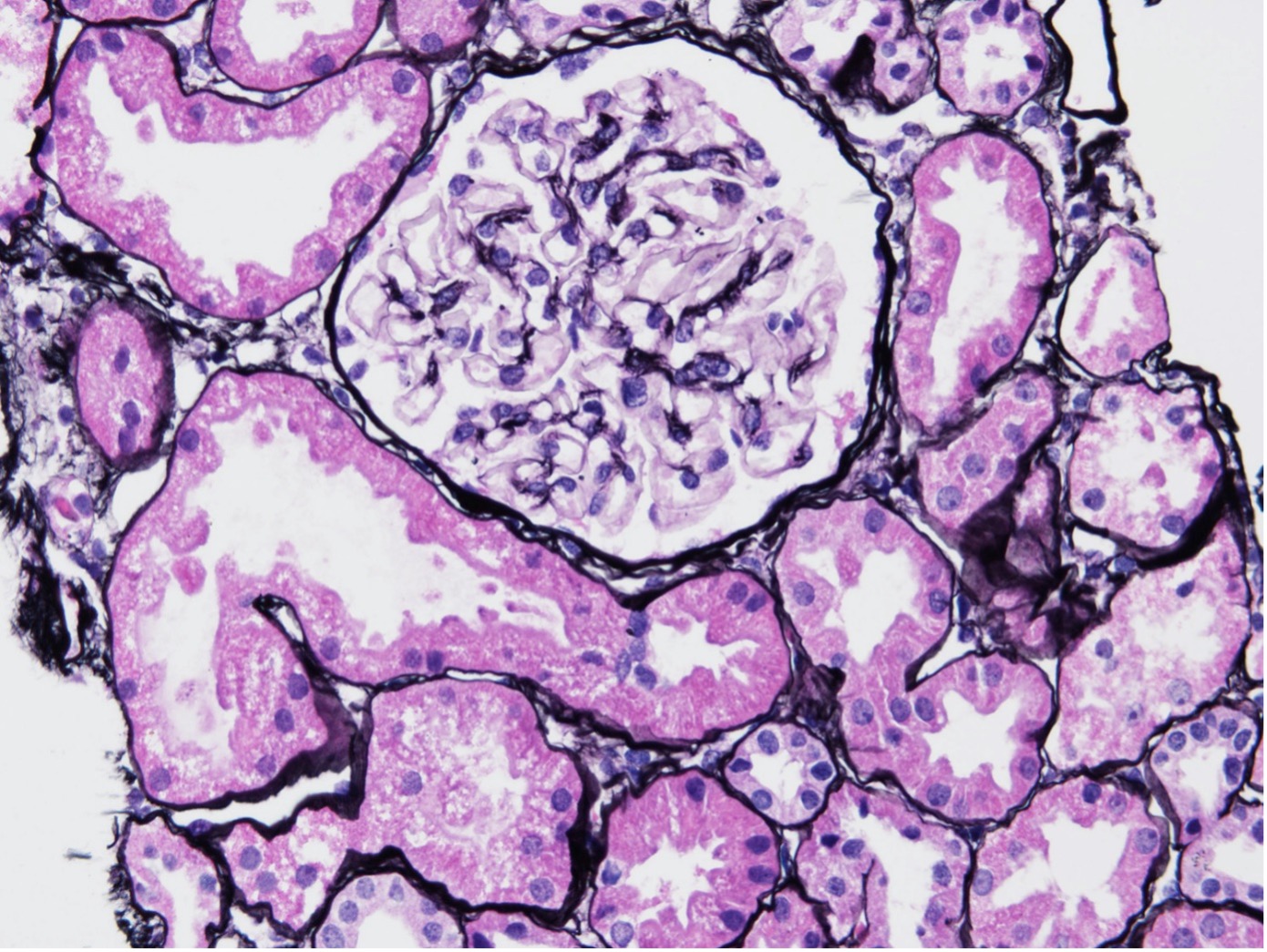 Vergrößerte Darstellung eines Nierenschnitts bei Lupus-Nephritis der Klasse I