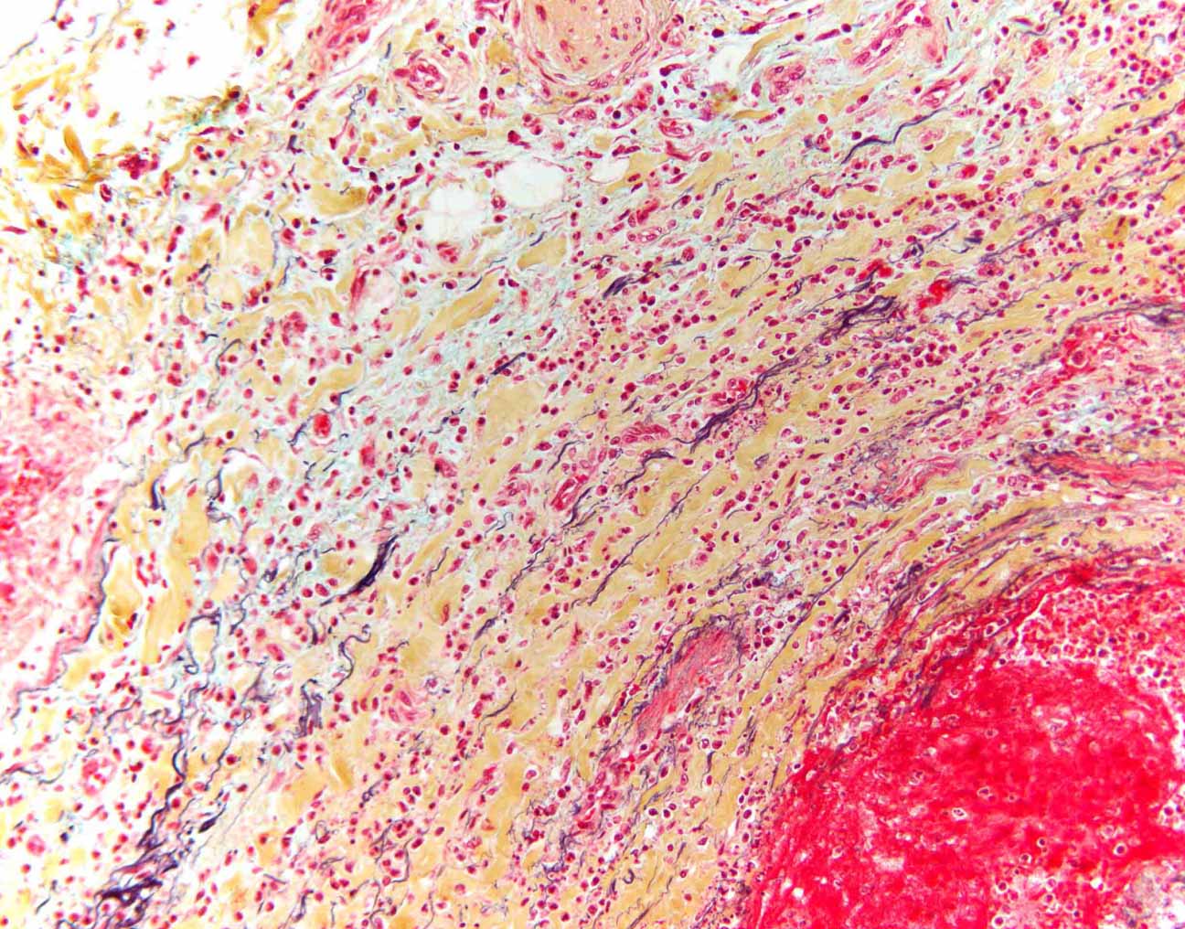 Pentachrom-Färbung eines Blutgefäßes unter dem Mikroskop