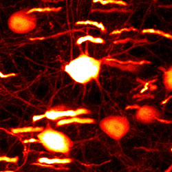 脳の神経細胞を観察した様子