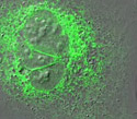 Human Osteosarcoma Epithelial Cells with EYFP ER