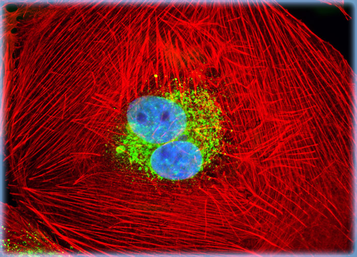 normal african green monkey kidney fibroblast cells  cv