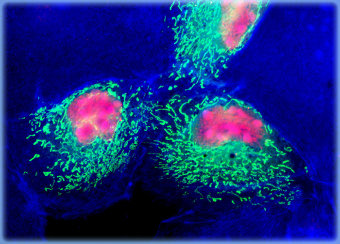 Human Cervical Adenocarcinoma Cells (HeLa Line)