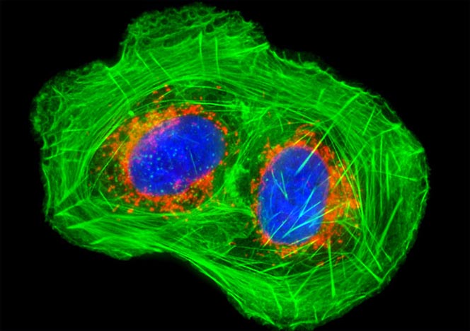 Human Bone Osteosarcoma Cells (U-2 OS Line) | Olympus LS