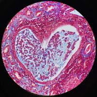 Utérus de chienne observé au microscope