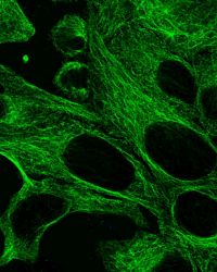 HeLa-Zellen unter dem Mikroskop