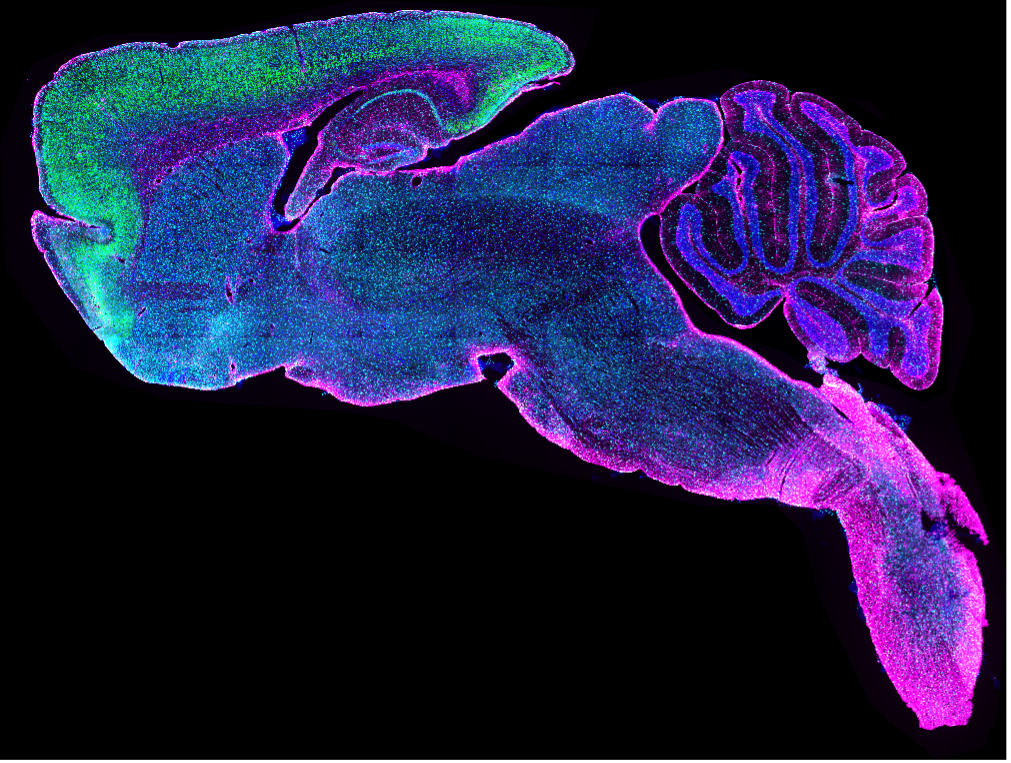 Bild eines ganzen Objektträgers mit einem gefärbten Sagittalschnitt des Mäusegehirns