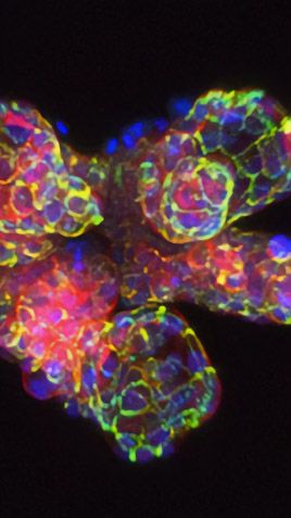 Organoid and 3D Imaging