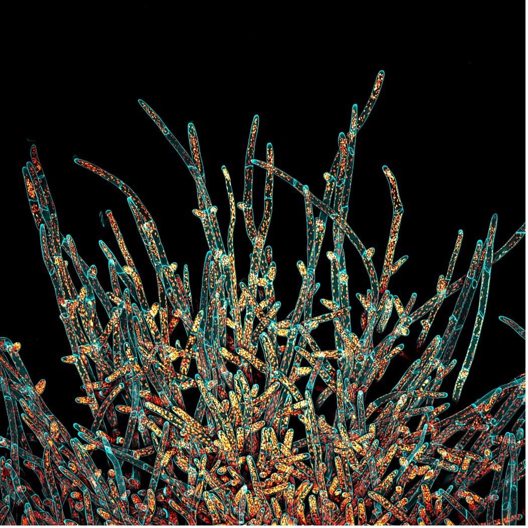 Mikroskopisch dekonvolviertes Z-Stapel-Bild von Protonema-Zellen des Kleinen Blasenmützenmooses (Physcomitrium patens).