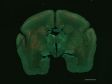 Observación de las estructuras neuronales entre la corteza y el tálamo en el cerebro de un tamarino con FLUOVIEW FV3000