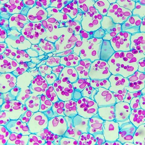 Cellules de parenchyme de réserve observée au microscope
