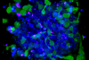 FV3000によるスフェロイド三次元タイムラプスイメージング ：抗体依存性細胞障害（ADCC）の48時間連続イメージング
