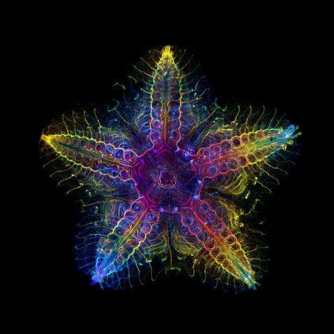 2022 Global IOTY winner showing a juvenile sea star under the microscope