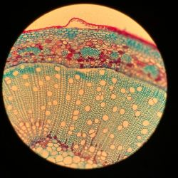 显微镜下的柳树枝条