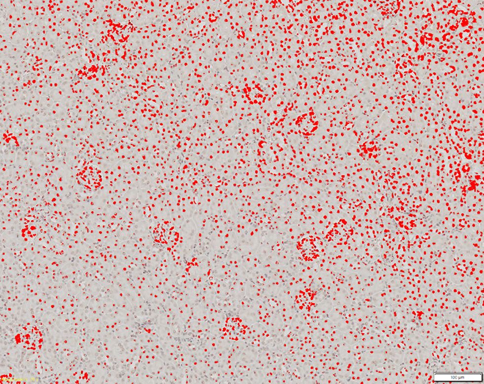 grossissement x10 illustrant l’échec de la détection par la méthode de détection par seuil conventionnelle (en rouge) des cellules glomérulaires par rapport aux autres cellules présentes dans le tissu.