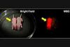 硅油物镜在小鼠胚胎发育过程中长时间3D活细胞成像中的应用