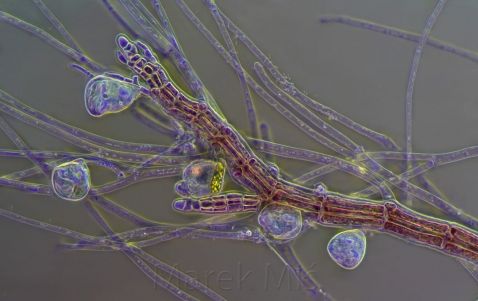 Vorticella em alga vermelha