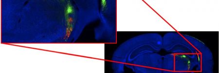 Imaging eines kompletten Objektträgers: Bild eines Mausgehirns