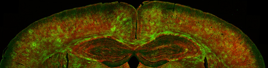 Investigación de la mielina para el Alzheimer