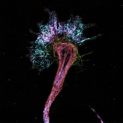 Axon growth cone under a microscope