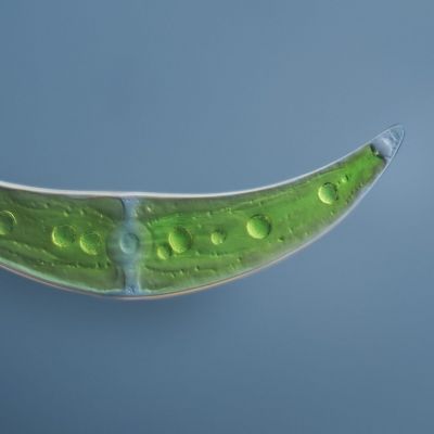 Closteriumと呼ばれる緑藻