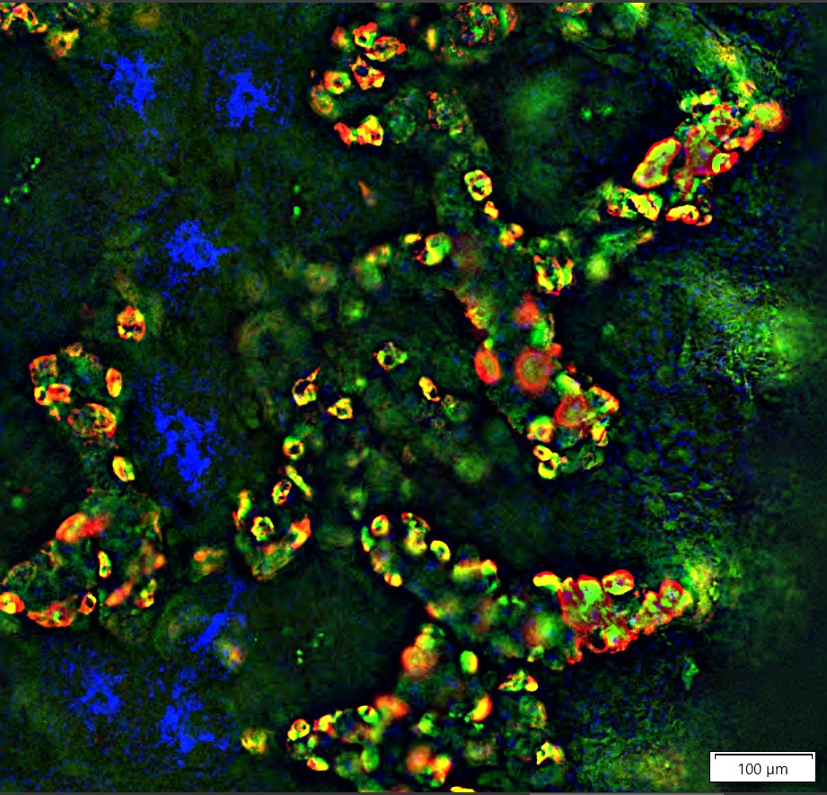 S. mediterranea stained with double fluorescent (red and green) in situ hybridization and scanned at 10X magnification image with one plane.