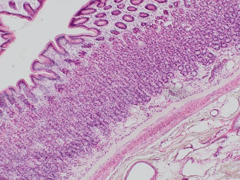 Application image of HE stained colon section