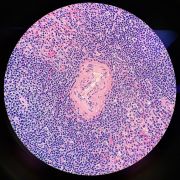 histology stained spleen slice