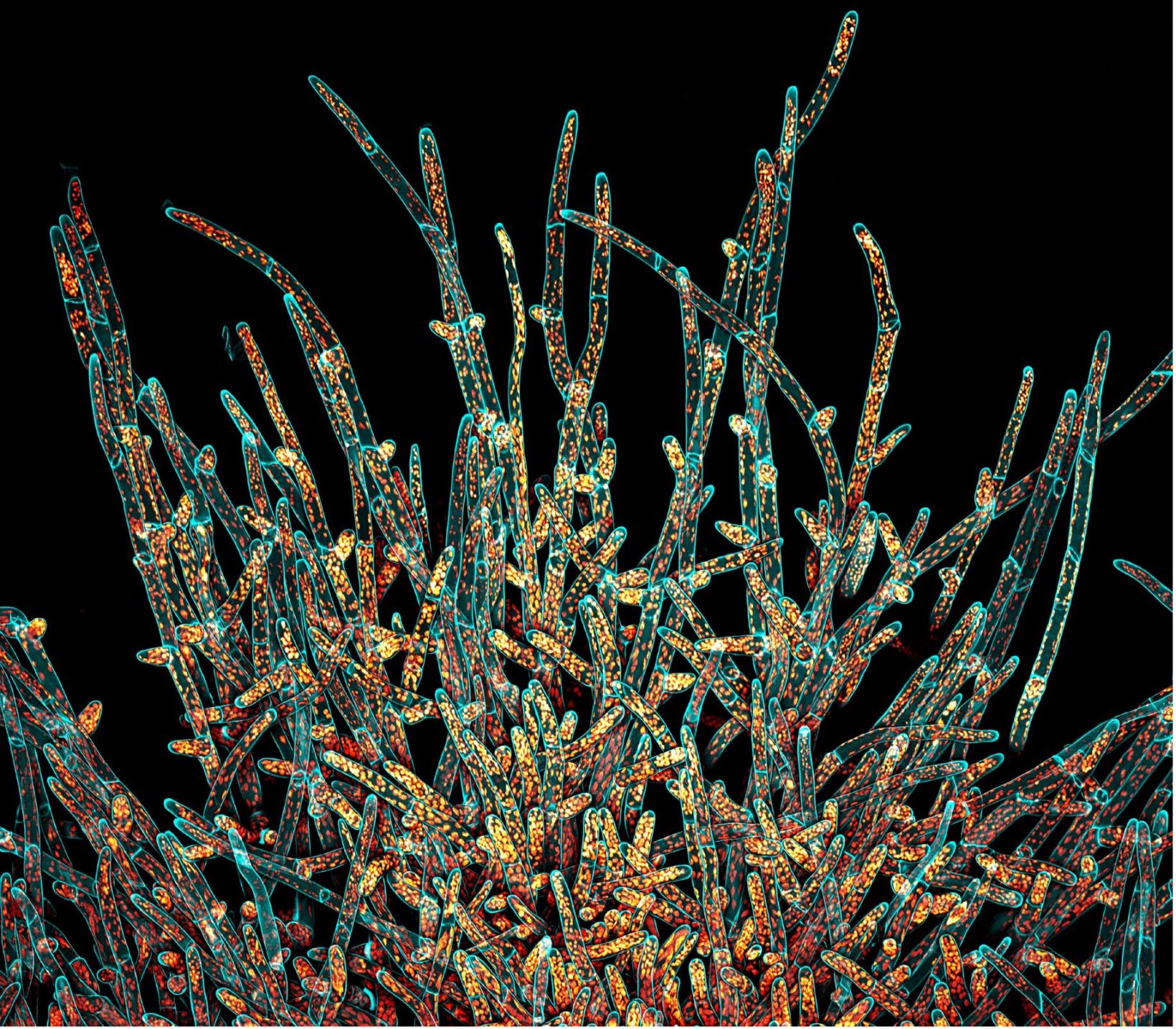 Image de cellules protonémiques de mousse Physcomitrium patens, image gagnante du concours IOTY de 2021 pour la région Amériques