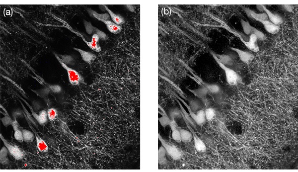 Figure 18. High dynamic range imaging using the SilVIR detector. Figure 18(a) shows a conventional image where some brighter cell body easily got saturated while 18(b) shows an image captured using the SilVIR detector where both cell body and neural fibers were in the detection range. Dim neural fibers were enhanced by adjusting the gamma display.