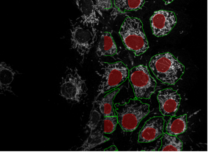 COS-7細胞のディープラーニング画像セグメンテーション