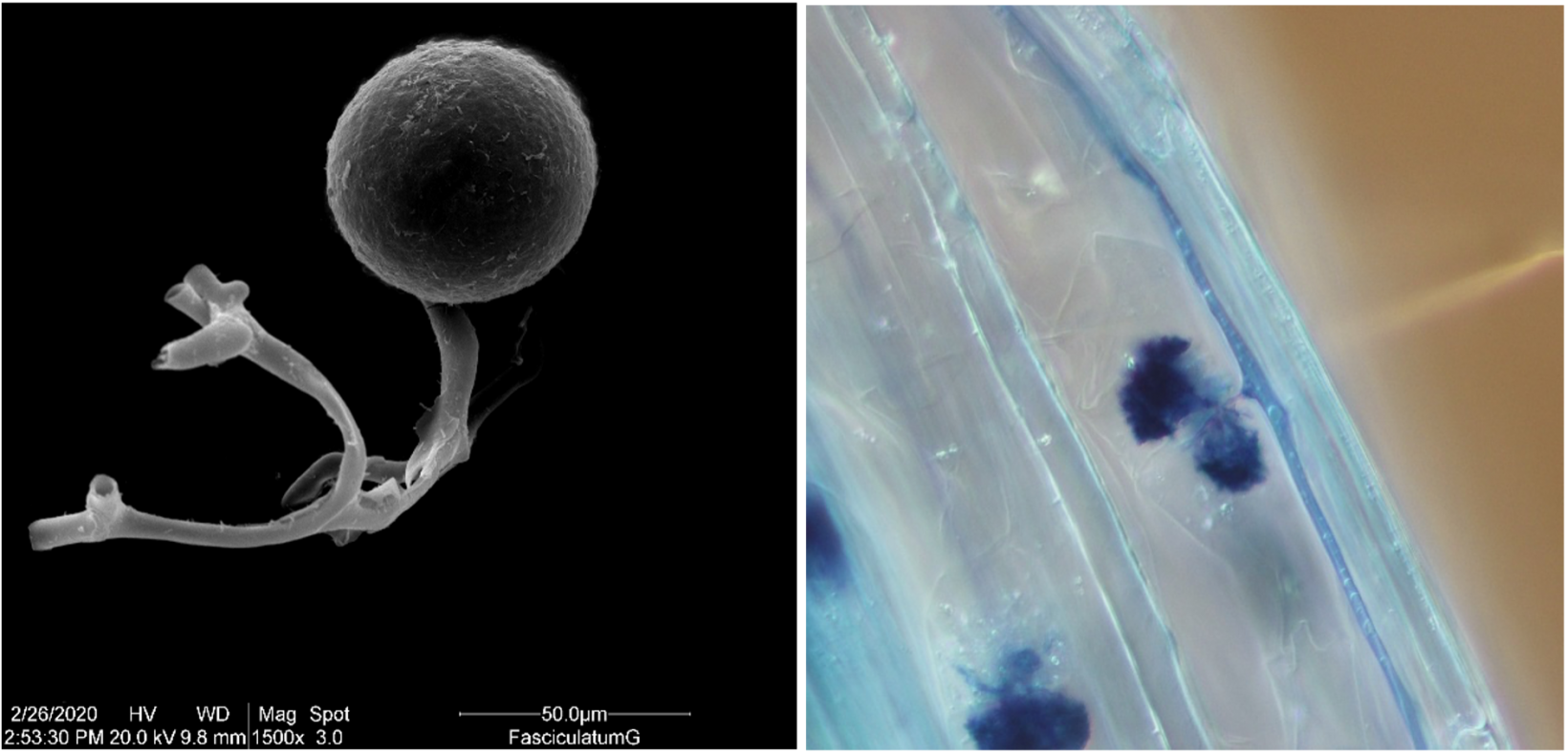 Structures microscopiques de spores mycorhiziennes et de champignons mycorhiziens connus sous le nom d’arbuscules