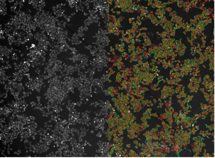 Deep learning image segmentation of HeLa cells